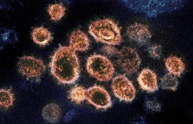 Un nouveau coronavirus proche du SARS-CoV-2 découvert au Royaume-Uni !