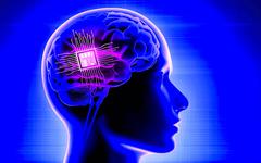 Un implant cérébral personnalisé utilisé avec succès pour le traitement de la dépression