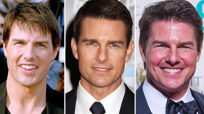 Tom Cruise choque la toile : l’acteur apparaît avec un visage bouffit et peu raisonnable !