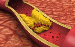 Cholestérol : Top 4 des régimes alimentaires pour le réduire efficacement