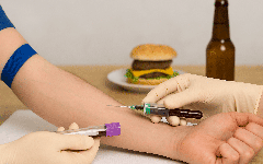 Ce que vous mangez la veille peut fausser un examen médical : les erreurs à éviter absolument !