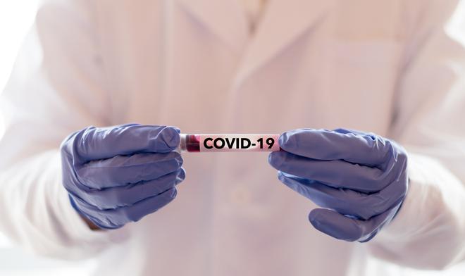 Covid-19 : un cocktail d’anticorps à l’étude promet une immunité immédiate