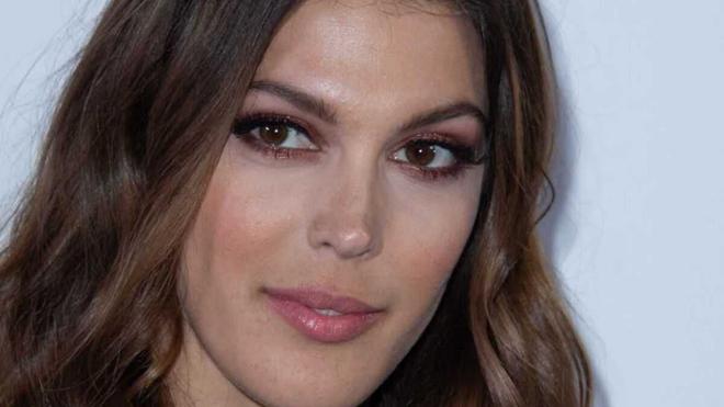 Iris Mittenaere : Lèvres pulpeuses, pommettes gonflées, la métamorphose de l’ex Miss France